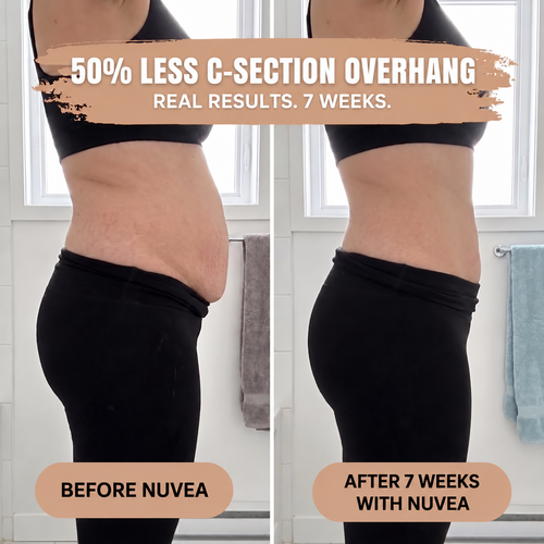 Nuvea Postpartum Support Brief